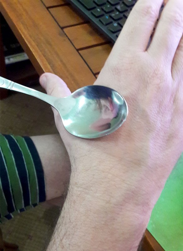 hot spoon on skin for mosquito bites
